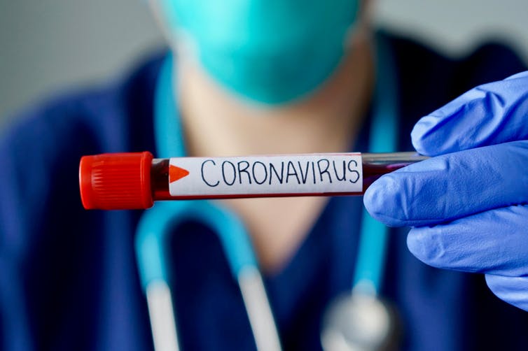 República Dominicana registra 1,149 nuevos contagios de COVID-19 y 5 muertes