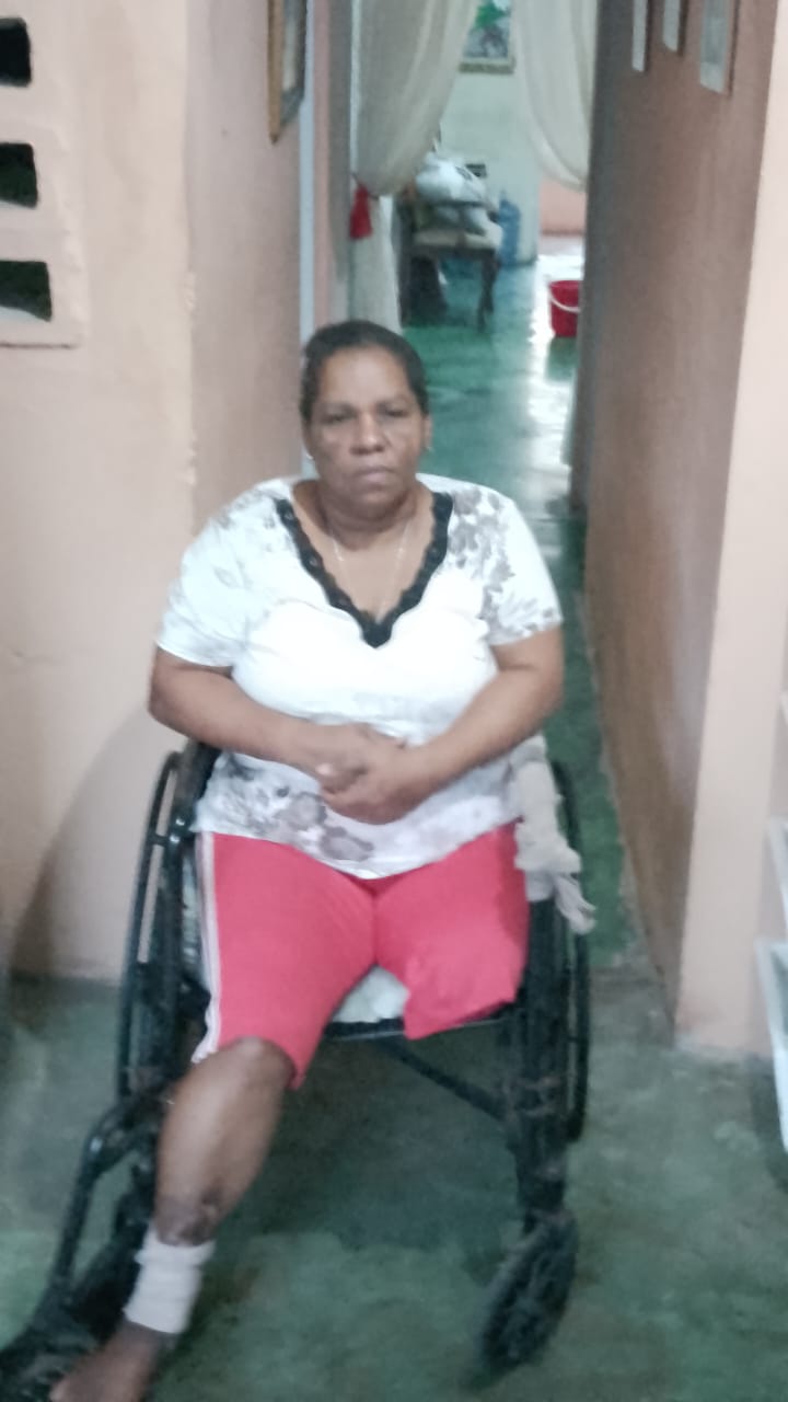 Mujer a la que le amputaron una pierna denuncia que fue desvinculada del Ministerio de Educación